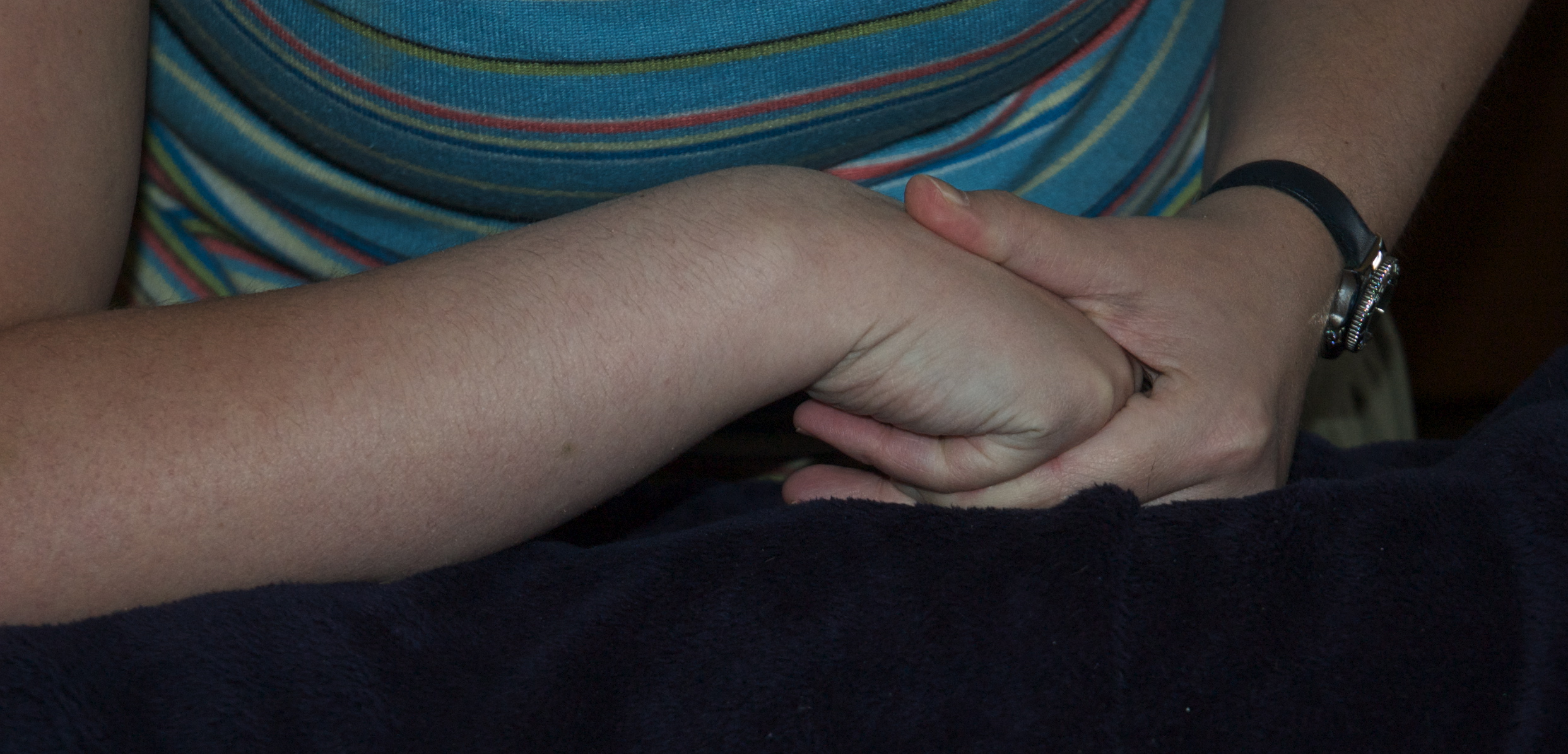 Syndrome d’Ehlers-Danlos - Flexion petit doigt à la phalange métacarpienne