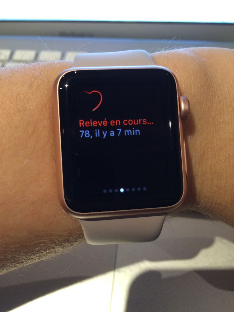 Apple Watch