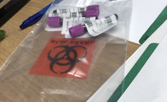 Des fioles de prises de sang dans un sac sur un bureau