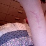 Site de la reconstruction du TFCC