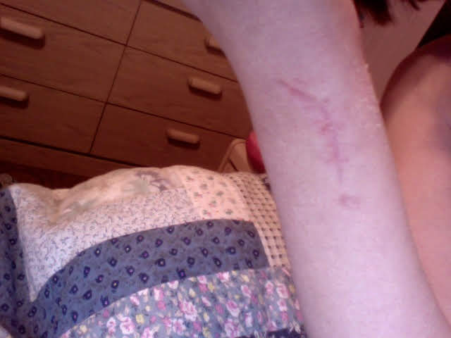 Site de la reconstruction du TFCC