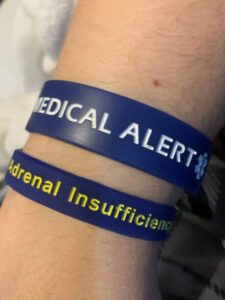 Photo de mes 2 bracelets médicaux, sur mon poignet. Ils sont bleus. Le premier indique "Medical Alert", le second "Adrenal insufficiency".