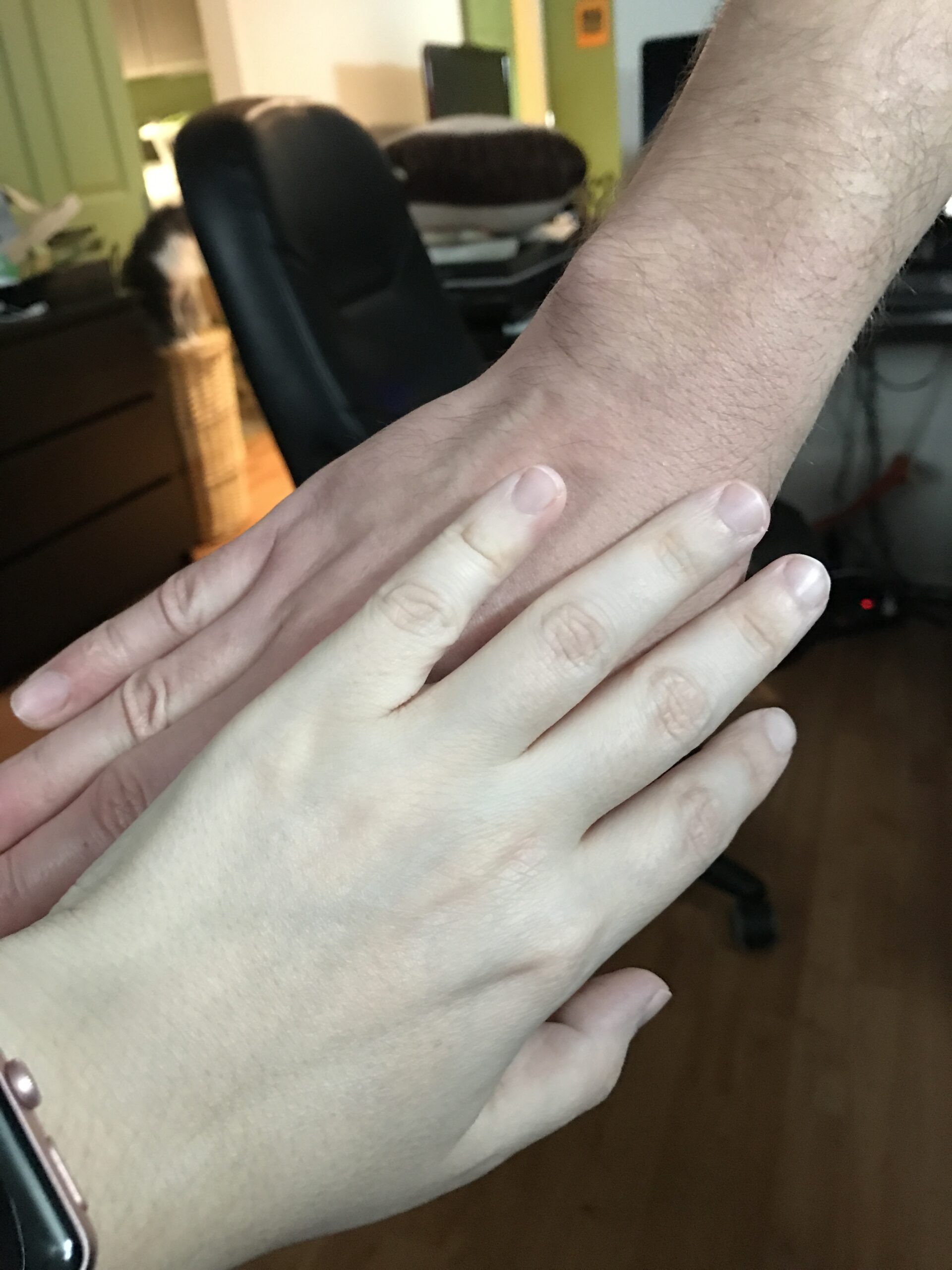 Ma main sur celle de mon conjoint. La mienne est clairement blanc-bleuté.