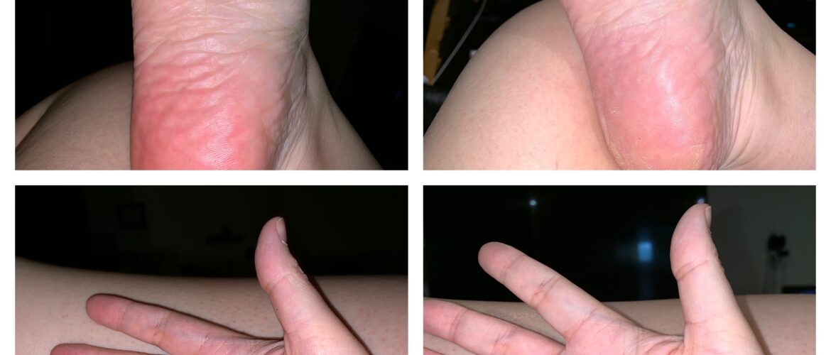 4 cadrans, les 2 du haut sont le dessous de mon pied droit, très rouge à gauche. Les 2 du bas sont la paume de ma main droite, très rouge à gauche.