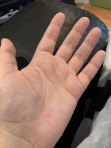 Ma main gauche, paume vers le haut... normale, donc un peu de rose au bout des doigts.